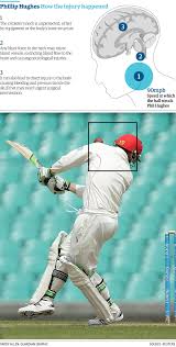 Which leads to the torque question, which is a fair bit harder. Being Hit On The Head Is Dangerous But The Neck Is Especially Vulnerable Australia Cricket Team The Guardian