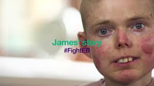 @CharityDEBRA's video Tweet