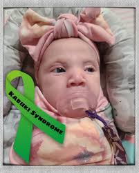 Hello everyone, my name is Dennis and I'm the dad of Yakup. I try to make a  wheelchair ramp car possible for my son