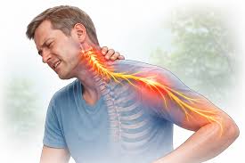 Bulging Disc in Neck: Causes, Signs, Treatment, and Recovery Guide