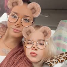 Squirrel rehab in Vancouver for broken arm