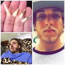 Jonathan Shelby ©️ (@_massuda_)