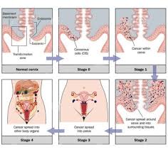 Le col utérin constitue la partie la plus basse de l'utérus bien que les hommes ne puissent pas contracter un cancer du col de l'utérus, ils peuvent quand même tirer parti des bienfaits du vaccin contre les. Conference Societe Americaine D Oncologie Le Vaccin Contre Le Cancer Du Col De L Uterus Disponible Fin 2016 Le Mauricien