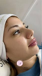 Dra. Yuliana Meza (@drayuliana.meza) · Instagram 照片和视频