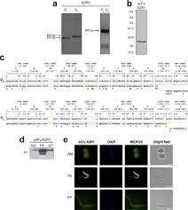 Recombinant Antibody Against Trypanosoma Cruzi From Patients With Chronic Chagas Heart Disease Recognizes Mammalian Nervous System Ebiomedicine