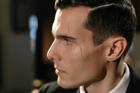 Waarom een 'wijnvlek' of litteken al snel tot onterechte afwijzing kan  leiden