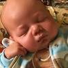 Story image for Cord Blood Transplant For Krabbe from WebMD