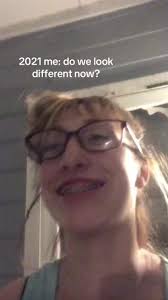 Peyton Tucker Before and After