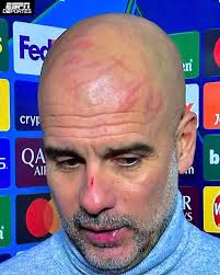 Con mis dedos... quiero lastimarme." En conferencia de prensa, Pep  Guardiola respondió por qué tenía rasguños en la cara después del empate de  Manchester City contra Feyenoord en UCL.