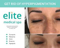 Smoking not only exposes your body and skin to several toxic chemicals, it also lowers antioxidant levels, which are responsible for renewing and keeping your skin. Skin Products To Get Rid Of Hyperpigmentation