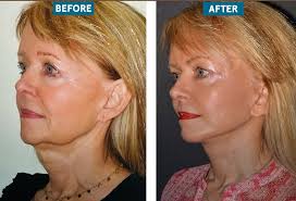 Dr Sam Rizk (@drsamrizk) • Instagram photos and videos