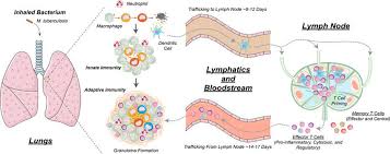 It was commonly called consumption at the turn of the last century because of the way the disease. Overview Of The Immune Response To Mycobacterium Tuberculosis Mtb Download Scientific Diagram
