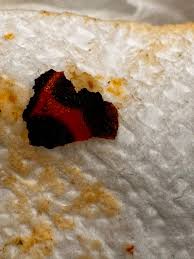 I just found a BUG WING OR BACK in my can of Protein lentil Progressive  Soup. Imma need them to do a better job