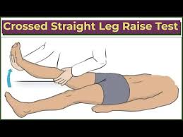 Image result for Crossed-Leg Test