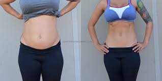 If you've lost a significant amount or weight of you've been pregnant and have loose or sagging skin, talk with a plastic surgeon about surgical options. Lose The Pooch 5 Exercises To Get Rid Of The Mommy Tummy Diary Of A Fit Mommy