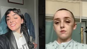 Columbia student struck by falling building debris in Wicker Park faces  'slow and tedious' recovery, will miss graduation