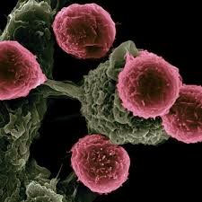 Although any of these symptoms can be caused by things other than breast cancer, if you have them, they should be reported to a health care professional so the cause can be found. Breast Cancer Early Signs Diagnosis And Treatment