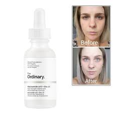 What does the ordinary 100% niacinamide powder do? The Ordinary Niacinamide 10 Zinc 1 30ml Shopee Indonesia