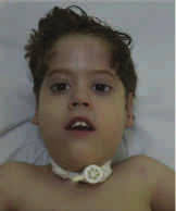 Physiopathologie et validation préclinique dans les myopathies  centronucléaires