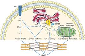 Molecular Mechanisms of Diaphragm Myopathy in Humans With Severe Heart  Failure | Circulation Research