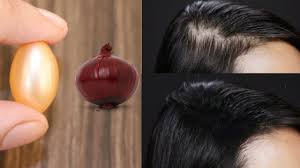 Vitamin e has been shown to be effective at promoting hair growth when taken as an oral supplement. Hair Regrowth Serum Onion And Vitamin E Oil Hair Growth Serum Youtube