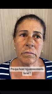 Dr Marco Antonio (@dr_marcoantonio) • Instagram photos and videos