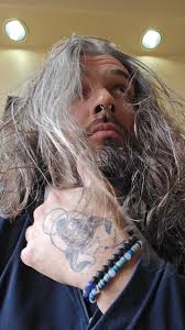 Addressing My Teeth Concerns: A Journey to Confidence