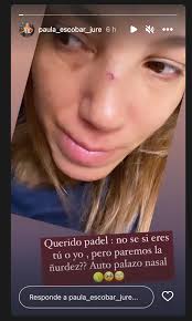 Me salió un montón de sangre”: Paula Escobar terminó moreteada después de  “auto palazo” en partido de pádel