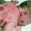 Pada usia beberapa hari kelahirannya, bayi sudahpun mula membuang najis yang digelar meconium yang berwarna hijau gelap atau kehitaman. Https Encrypted Tbn0 Gstatic Com Images Q Tbn And9gct1vvmrkf5vnnlqbr3 Ym4emt49ckeb8xqwqb6kmmpvbhj3jqrc Usqp Cau
