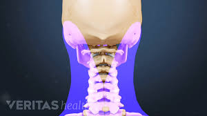 Neck Pain Causes Video
