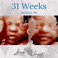 Love At First Sight 3D-Berwick