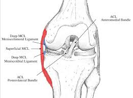 This page is about the various possible meanings of the acronym. Knee Mcl Surgery Not For This Avid Biker