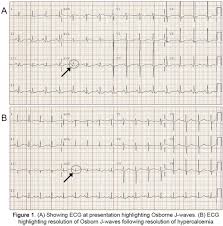 Image result for J Wave