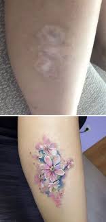 Back Birthmark Cover Up Tattoo Pin On Art Tattoo This