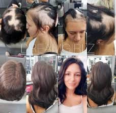 Последние твиты от hair salons near me (@hairsalonnearme). Hair Loss Dreamgirlz Hair Extensions