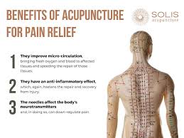 Image result for Acupuncture