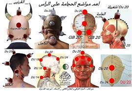 الحجامة و الطب البديل بالساحل أهم مواضع الحجامة في الرأس 1 المغيثة المنقذة النافعة أم مغيث موضع رقم 32 في الخرائط القديمة موضع رقم 1