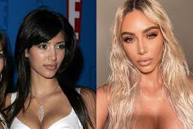 Kardashian has been known to edit her photos before sharing them to her 89 million follows. All The Kardashian Jenners Plastic Surgery Procedures Girlfriend