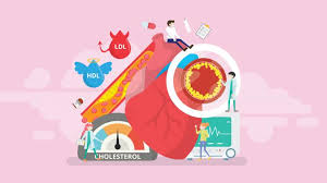 We did not find results for: High Cholesterol In Teens Early 20s Leads To Heart Problems By Middle Age Nhlbi Nih