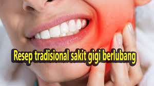 We did not find results for: Resep Sakit Gigi Obat Herbal Ampuh Hilang Rasa Sakit Gigi Berlubang Pegiat Literasi Com