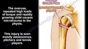 Image result for Humerus Growth Plates