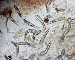 Demodex mites can also drain the vital fluids and oils the skin needs for nourishment. Spots Hair Loss Caused By Mites Vetwest Animal Hospitals