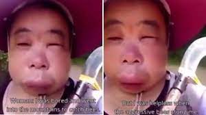 Sederet cara mengatasi sengatan lebah menggunakan ramuan obat tradisional? Nekat Curi Sarang Lebah Lihat Apa Yang Terjadi Pada Wajah Wanita Ini Citizen6 Liputan6 Com