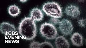 Is gray paint going out of style? Man Suffers 4 Hour Erection With Covid 19 Coronavirus Infection