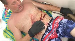 RÃ©sultat de recherche d'images pour "Un plongeur se fait manger lâestomac par un requin !!"