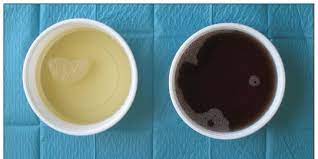 Maybe you would like to learn more about one of these? Air Seni Berwarna Hitam Ini 5 Kemungkinan Penyebabnya Merdeka Com