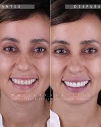 Od. María Jesús Bello