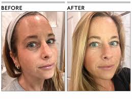 The 10 Best Pore Minimizers of 2025, Tested and Reviewed