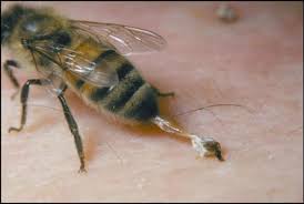 Do Bees Really Die After They Sting You Bee Sting Bee Venom Wasp Stings