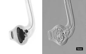 Radiation detection plays an important role in many application fields such as nuclear medicine, power generation, border control and nuclear decommissioning. Phase Contrast X Ray Imaging Wikipedia